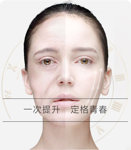 线雕提拉术