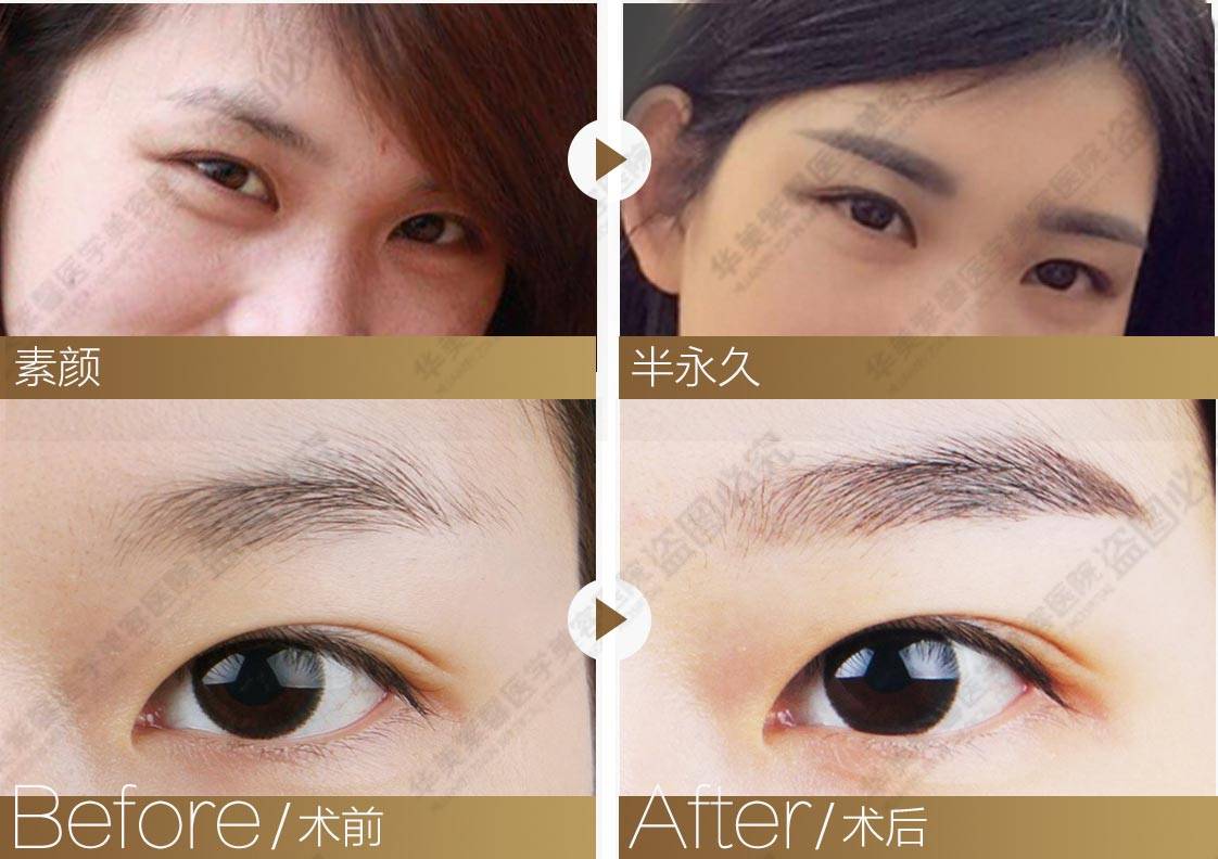 眉毛稀疏、杂乱、不对称。